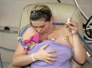 Petrova bolnica 21.05.2017 odjel neonatologije Majka Bojanu Plantak u kontaktu "koža na kožu" sa sinom Ivanom.(31.tjedan) Ivan je rođen sa 980 grama u 25.tjednu. Prema riječima Dr. Snježane Gverić Ahmetašević nakon tretmana "koža na kožu" dobro napreduje i u 31. danu teži 1270 g.
