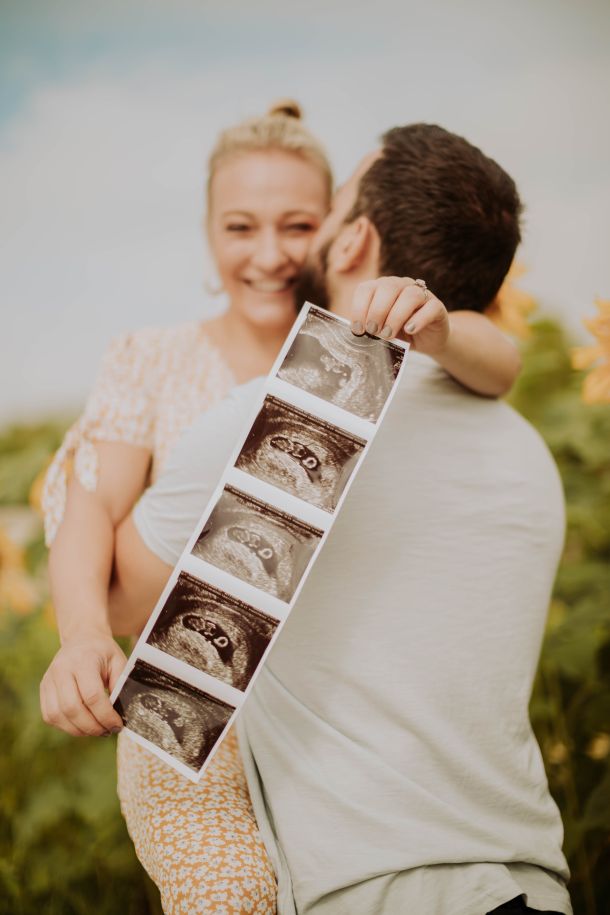 ultrazvuk u trudnoci trudnica